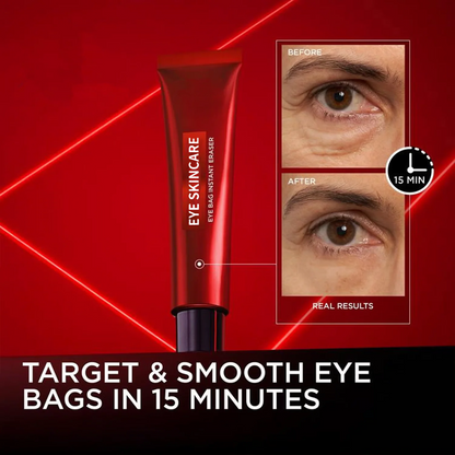 ✨EYE BAG INSTANT ERASER – LOOK 10 YEARS YOUNGER IN SECONDS!✨