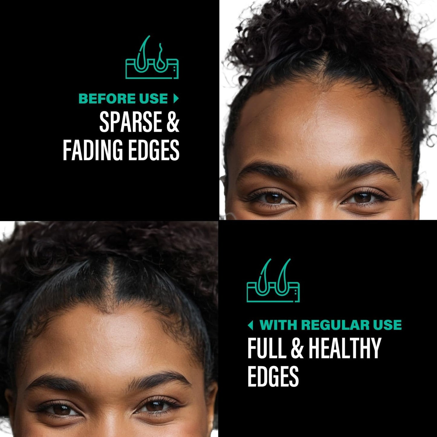 100% Unrefined Batana Oil – Strengthen, Smooth & Revive Damaged Hair Naturally