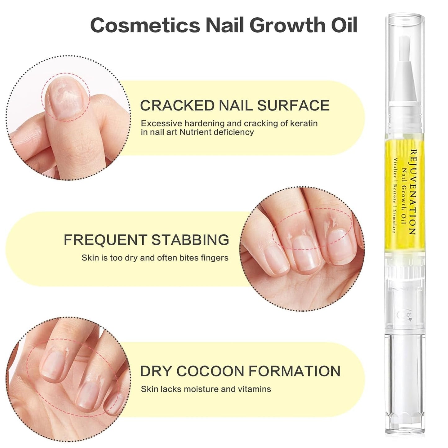 Rejuvenation Natural Nail Growth Oil (2PCS)