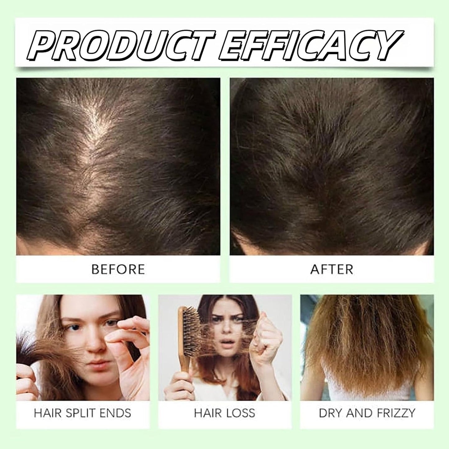 Anti-Hair Fall Hair Loss Treatment Shampoo (2 PCS)