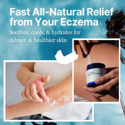 The Ocean Healed My Eczema™ – Eczema & Psoriasis Relief for Sensitive Skin