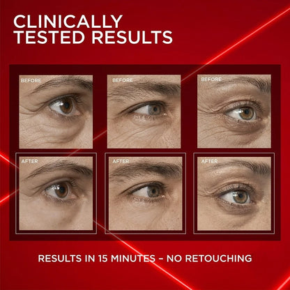 ✨EYE BAG INSTANT ERASER – LOOK 10 YEARS YOUNGER IN SECONDS!✨