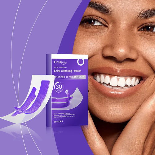 Teeth Whitening Strips — Whiter Teeth in Just 30 Minutes