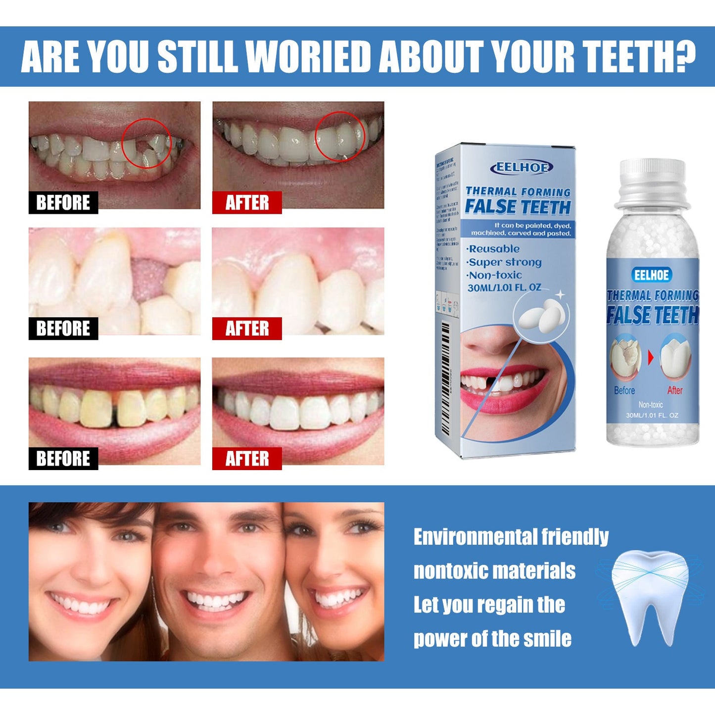 Eelhoe Temporary Tooth Repair: Perfect Solution for Gaps and Missing Teeth!✨